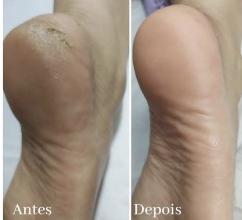 Imagem WhatsApp 2025-09-22 às 21.01.32_6b8e94f0